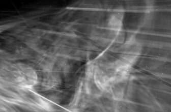 Behold the Closest Pictures of the Solar Ever Taken